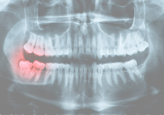 Treatment - Wimbledon Dental